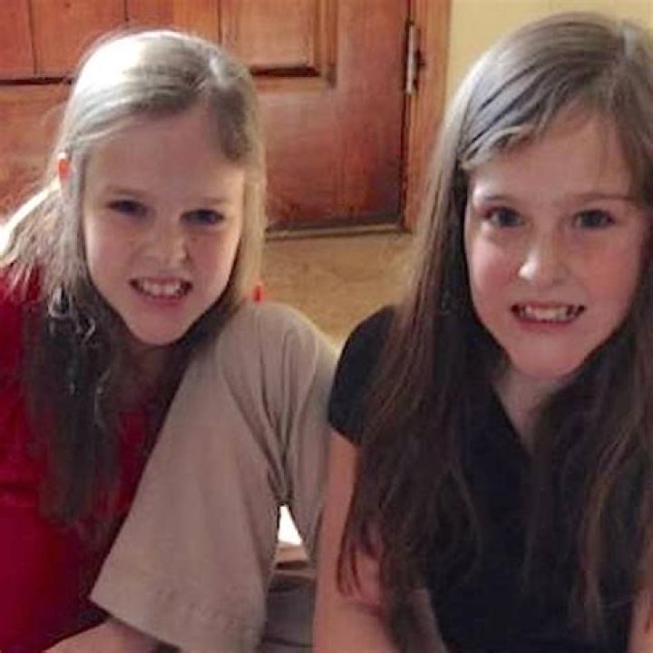 Cojoined twin sisters who were famously ‘cut In half’ in 2006 are now living as separate teenagers